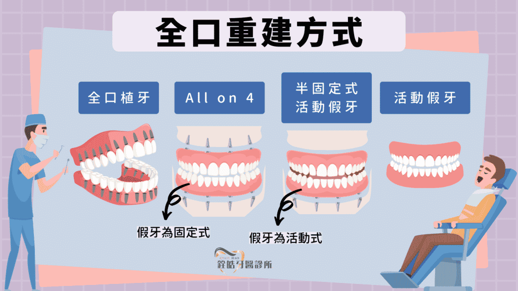 缺牙全口重建治療方式