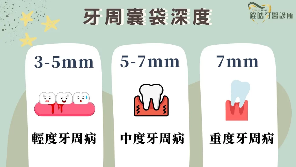 牙周囊袋恢復 | 牙周囊袋深度與牙周病有關！