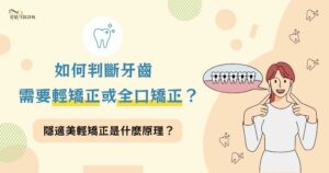 如何判斷牙齒需要輕矯正或全口矯正？