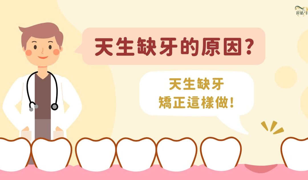 天生缺牙原因有哪些？天生缺牙矯正這樣做！