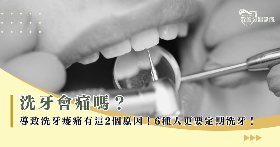 洗牙會痛嗎？導致洗牙痠痛有這 2 個原因！6 種人更要定期洗牙！