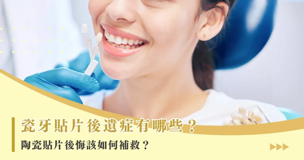 瓷牙貼片後遺症有哪些？陶瓷貼片後悔該如何補救？