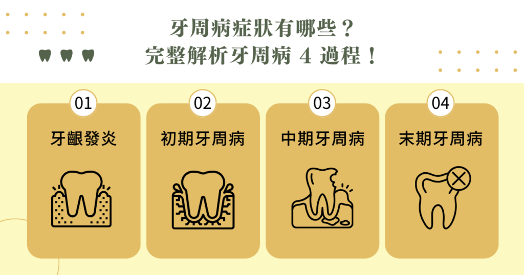 牙周病症狀有哪些？完整解析牙周病 4 過程！