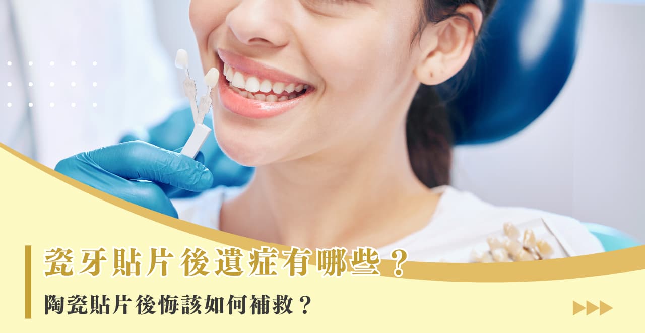 瓷牙貼片後遺症有哪些？陶瓷貼片後悔該如何補救？