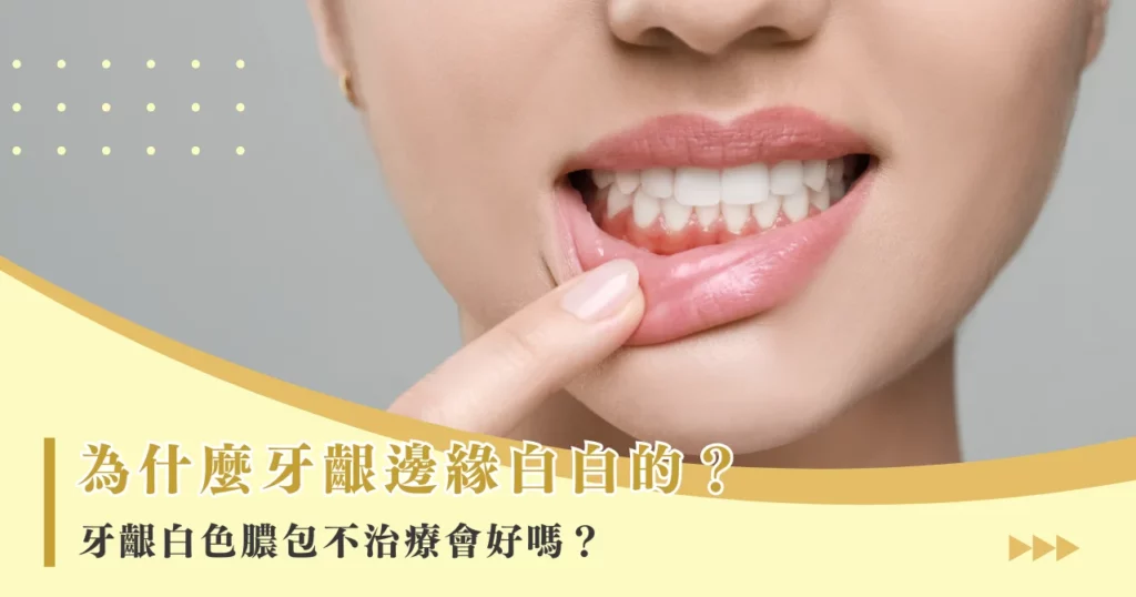 為什麼牙齦邊緣白白的？牙齦白色膿包不治療會好嗎？