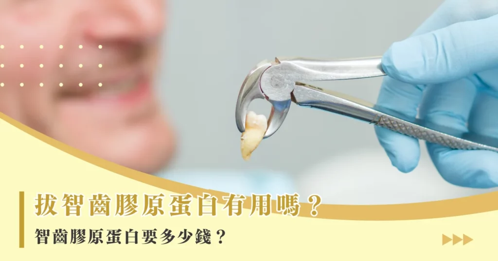 拔智齒膠原蛋白有用嗎?智齒膠原蛋白要多少錢?