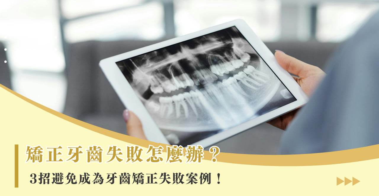 矯正牙齒失敗怎麼辦？ 3 招避免成為牙齒矯正失敗案例！