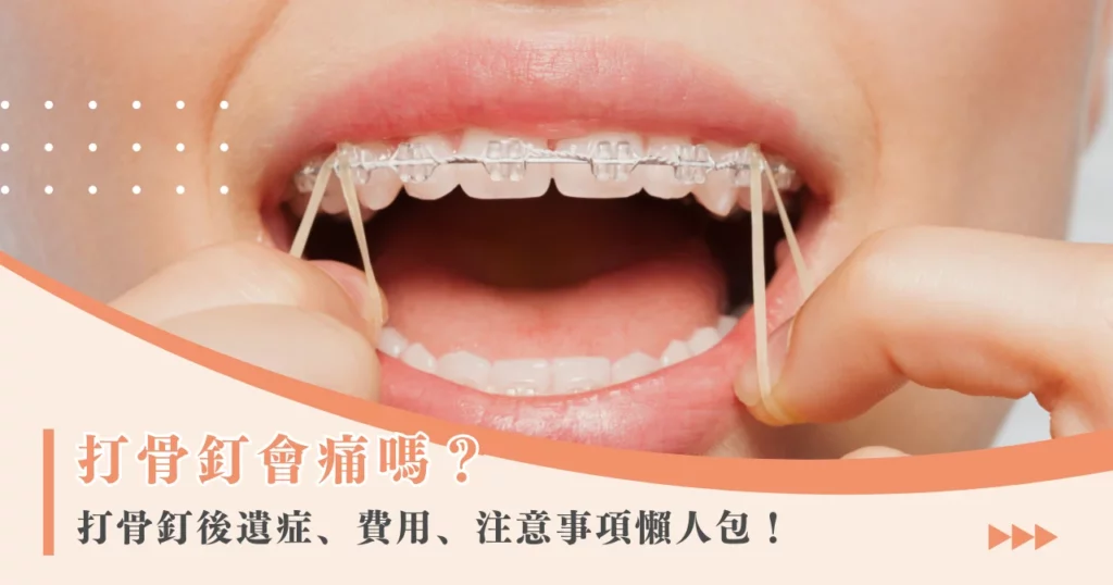 打骨釘會痛嗎？打骨釘後遺症、費用、注意事項懶人包！
