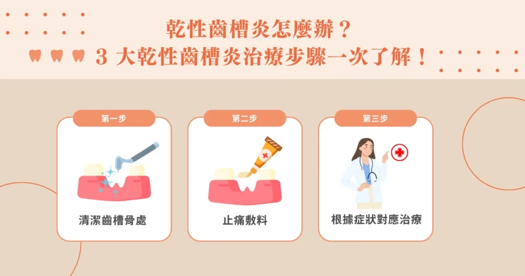 乾性齒槽炎怎麼辦？ 3 大乾性齒槽炎治療步驟一次了解！