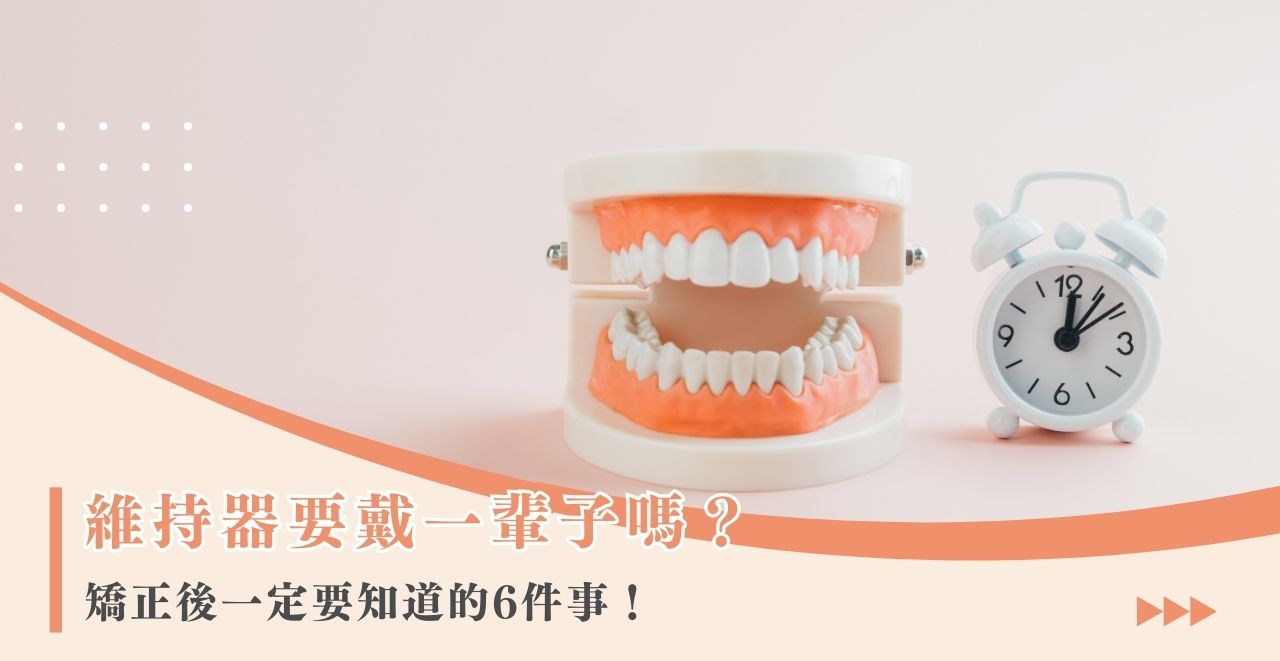 維持器要戴一輩子嗎？矯正後一定要知道的6件事！