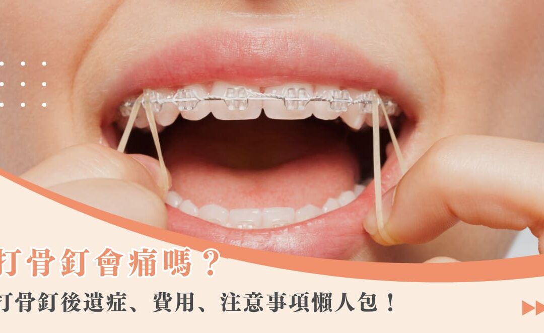 打骨釘會痛嗎？打骨釘後遺症、費用、注意事項懶人包！
