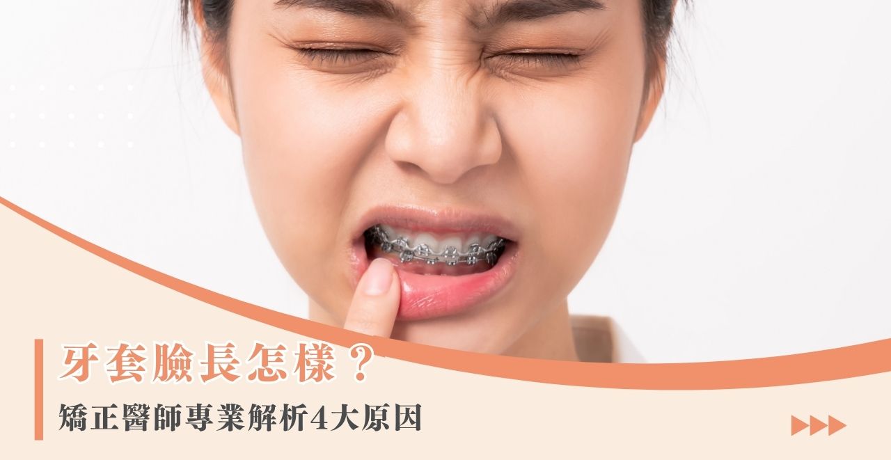 牙套臉長怎樣？矯正醫師專業解析 4 大原因